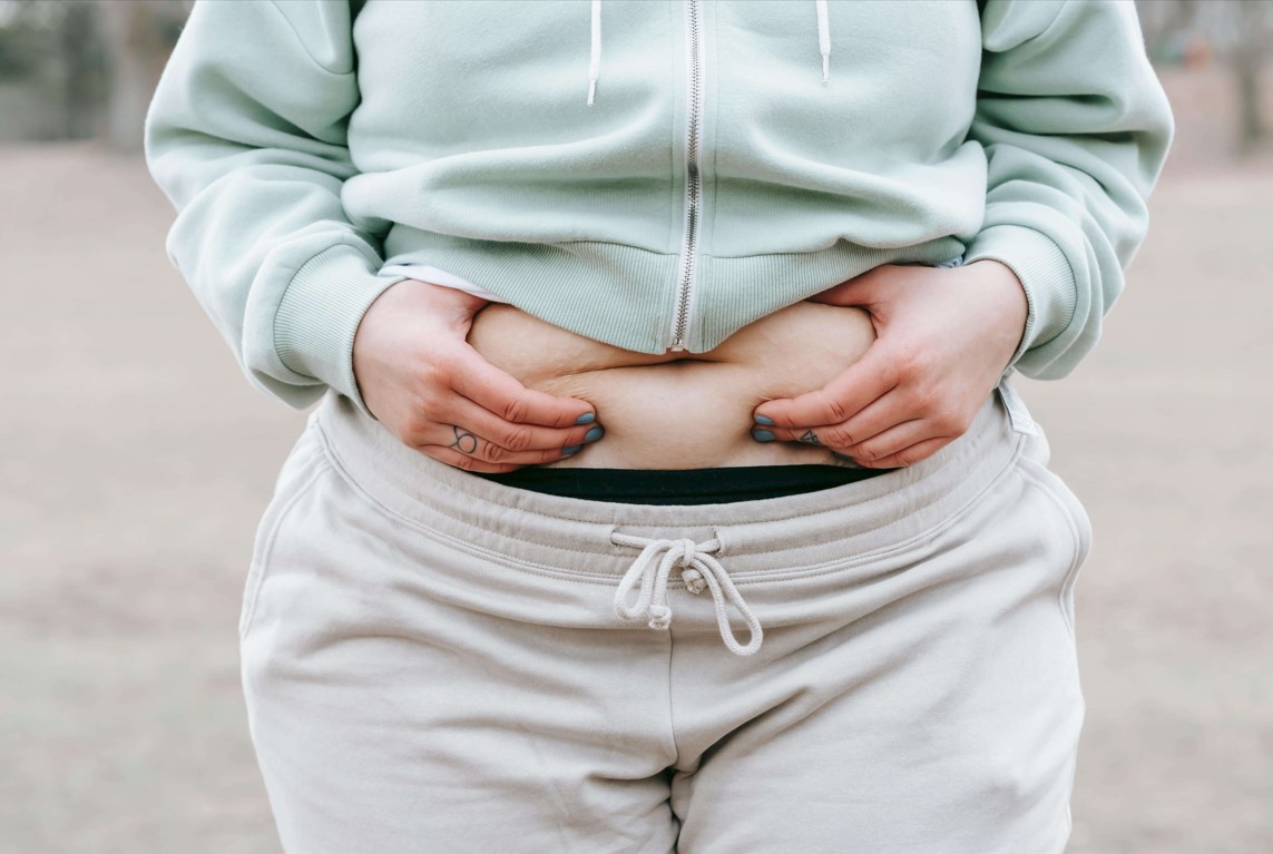 Lipoescultura láser en Medellín (Colombia): un procedimiento eficaz para reducir grasa localizada